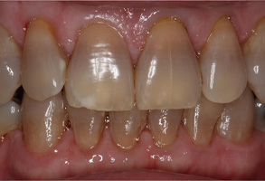 Perfect Smile Dental Studio | Pediatric Dentistry, Teeth Whitening and Dentures