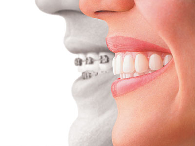 Perfect Smile Dental Studio | Oral Cancer Screening, Preventative Program and Ceramic Crowns