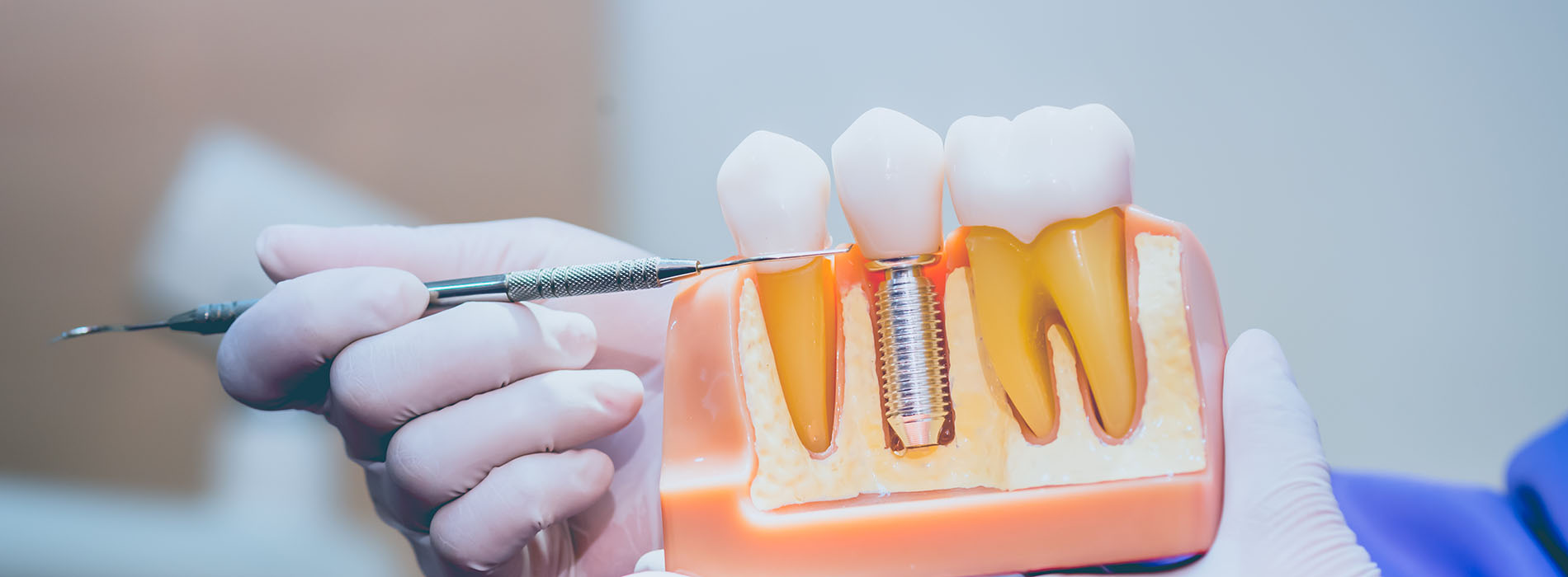 Perfect Smile Dental Studio | Implant Dentistry, Dentures and Inlays amp Onlays