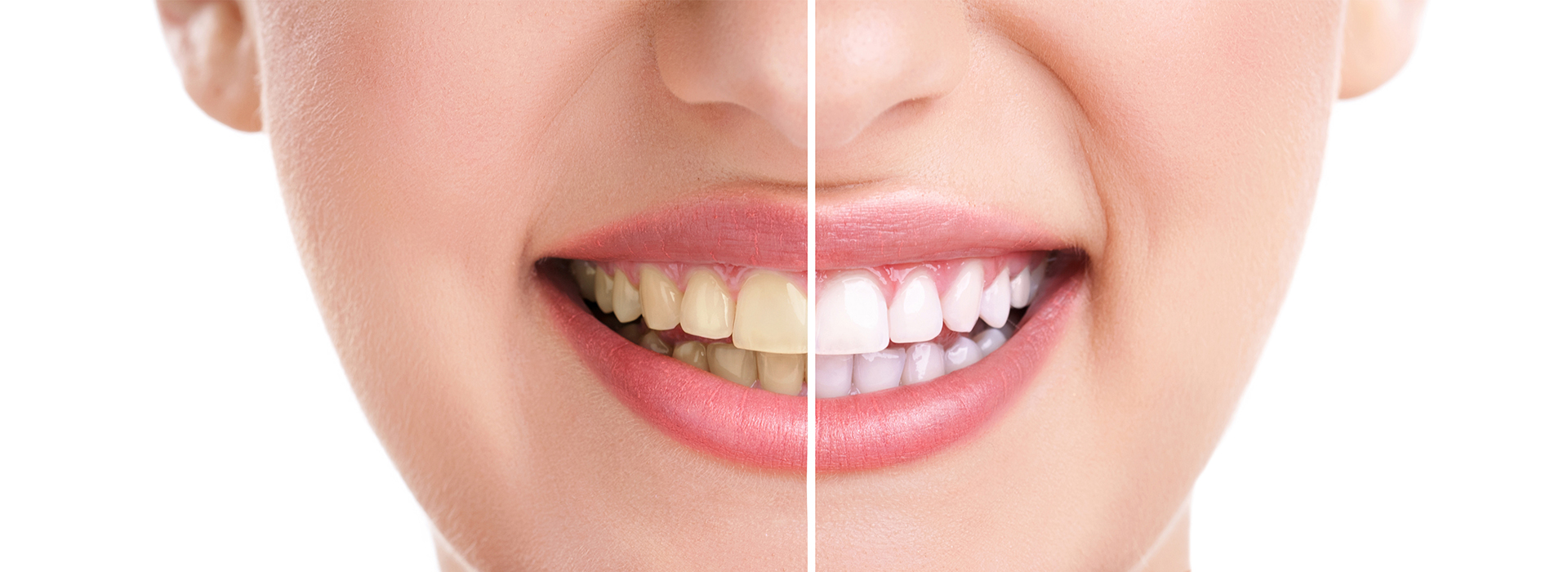 Perfect Smile Dental Studio | Cosmetic Dentistry, Dental Bridges and Periodontal Treatment