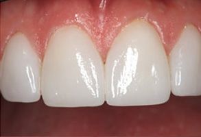 Perfect Smile Dental Studio | K R Whitening, Dental Fillings and Dental Cleanings
