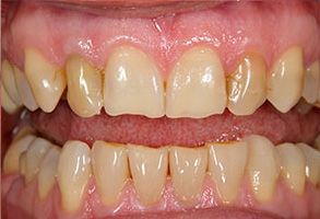 Perfect Smile Dental Studio | Veneers, Emergency Treatment and Inlays amp Onlays