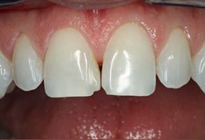 Perfect Smile Dental Studio | Teeth Whitening, Oral Cancer Screening and K R Whitening